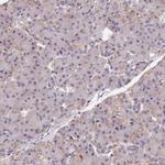 ARHGAP17 Antibody in Immunohistochemistry (Paraffin) (IHC (P))