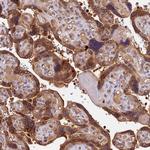 ARHGAP17 Antibody in Immunohistochemistry (Paraffin) (IHC (P))