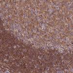 ARHGAP17 Antibody in Immunohistochemistry (Paraffin) (IHC (P))