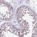 PIGU Antibody in Immunohistochemistry (Paraffin) (IHC (P))