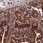 CCDC124 Antibody in Immunohistochemistry (Paraffin) (IHC (P))