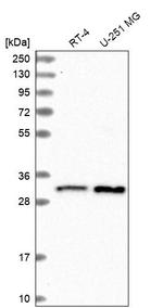 CCDC124 Antibody in Western Blot (WB)