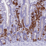 FKBP11 Antibody in Immunohistochemistry (Paraffin) (IHC (P))