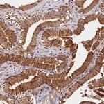 KPTN Polyclonal Antibody