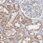 ZNF606 Polyclonal Antibody