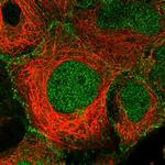 PALM Polyclonal Antibody