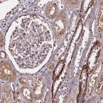 PALM Antibody in Immunohistochemistry (Paraffin) (IHC (P))