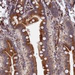 TRAPPC2L Antibody in Immunohistochemistry (Paraffin) (IHC (P))