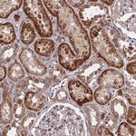 TRAPPC2L Antibody in Immunohistochemistry (Paraffin) (IHC (P))