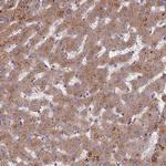 TRAPPC2L Antibody in Immunohistochemistry (Paraffin) (IHC (P))