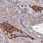 TRAPPC2L Antibody in Immunohistochemistry (Paraffin) (IHC (P))