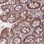 CCDC184 Antibody in Immunohistochemistry (Paraffin) (IHC (P))