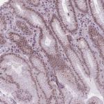 TIGD1 Antibody in Immunohistochemistry (Paraffin) (IHC (P))