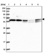 TIGD1 Antibody in Western Blot (WB)