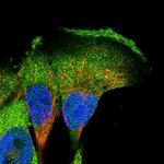 CKAP1 Polyclonal Antibody