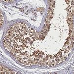 CKAP1 Antibody in Immunohistochemistry (IHC)