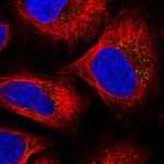 SULT2B1 Polyclonal Antibody