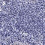 SULT2B1 Antibody in Immunohistochemistry (Paraffin) (IHC (P))