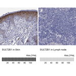 SULT2B1 Antibody in Immunohistochemistry (Paraffin) (IHC (P))