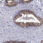 SULT2B1 Antibody in Immunohistochemistry (Paraffin) (IHC (P))