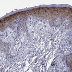 SULT2B1 Antibody in Immunohistochemistry (Paraffin) (IHC (P))