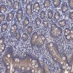 SULT2B1 Antibody in Immunohistochemistry (Paraffin) (IHC (P))