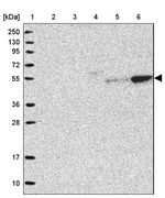 LYPLA3 Antibody in Western Blot (WB)