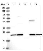 NPVF Antibody in Western Blot (WB)