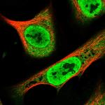 RPAP1 Polyclonal Antibody