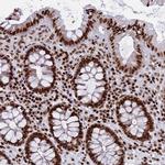 RPAP1 Antibody in Immunohistochemistry (Paraffin) (IHC (P))