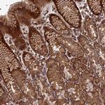 DEF8 Polyclonal Antibody