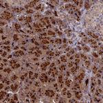 AP4E1 Polyclonal Antibody