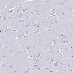Galectin 10 Antibody in Immunohistochemistry (Paraffin) (IHC (P))