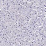 Galectin 10 Antibody in Immunohistochemistry (Paraffin) (IHC (P))