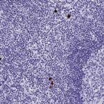 Galectin 10 Polyclonal Antibody