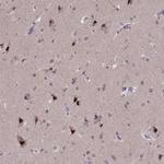 CRAMP1L Antibody in Immunohistochemistry (Paraffin) (IHC (P))