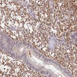 CRAMP1L Antibody in Immunohistochemistry (Paraffin) (IHC (P))