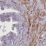 CRAMP1L Antibody in Immunohistochemistry (Paraffin) (IHC (P))