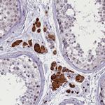 CRAMP1L Antibody in Immunohistochemistry (Paraffin) (IHC (P))