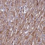 RRAD Antibody in Immunohistochemistry (Paraffin) (IHC (P))