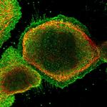 SYMPK Polyclonal Antibody