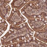 SYMPK Antibody in Immunohistochemistry (Paraffin) (IHC (P))