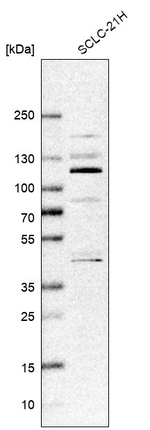 ZNF598 Antibody in Western Blot (WB)