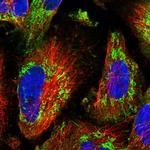 C19orf61 Polyclonal Antibody