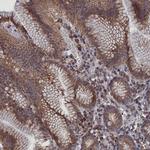 C19orf61 Antibody in Immunohistochemistry (Paraffin) (IHC (P))
