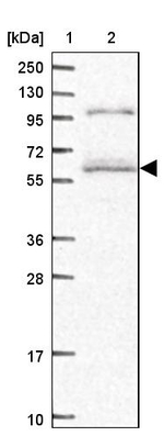 C19orf61 Antibody in Western Blot (WB)
