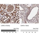 LDHD Antibody in Immunohistochemistry (IHC)