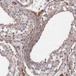 LDHD Antibody in Immunohistochemistry (IHC)