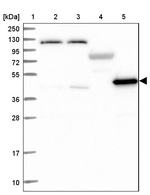LDHD Antibody in Western Blot (WB)