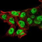 CT112 Polyclonal Antibody